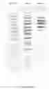 Fig. 11 - Modified human erythropoietin