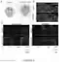 Fig. 12 - NOVEL METHOD