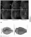 Fig. 22 - NOVEL METHOD