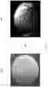 Fig. 07 - Dermatological Imaging Systems and Methods for Generating Three-Dimensional (3D) Image Models