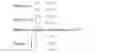 Fig. 09 - Decoding method and a decoder for subpicture syntax elements signalling
