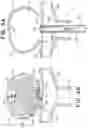 Fig. 07 - ANEURYSM TREATMENT DEVICE