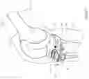 Fig. 08 - ARRANGEMENT AND METHOD USED IN THE PREPARATION OF BONE SURFACES OF THE KNEE JOINT FOR THE COMPONENTS OF A PROSTHETIC KNEE JOINT