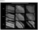Fig. 03 - OPTIMIZED GENE THERAPY TARGETING RETINAL CELLS
