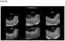 Fig. 04 - OPTIMIZED GENE THERAPY TARGETING RETINAL CELLS