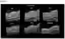 Fig. 05 - OPTIMIZED GENE THERAPY TARGETING RETINAL CELLS