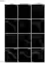 Fig. 06 - OPTIMIZED GENE THERAPY TARGETING RETINAL CELLS