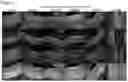 Fig. 10 - OPTIMIZED GENE THERAPY TARGETING RETINAL CELLS