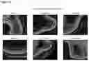 Fig. 11 - OPTIMIZED GENE THERAPY TARGETING RETINAL CELLS