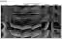 Fig. 12 - OPTIMIZED GENE THERAPY TARGETING RETINAL CELLS