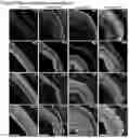 Fig. 18 - OPTIMIZED GENE THERAPY TARGETING RETINAL CELLS