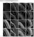 Fig. 19 - OPTIMIZED GENE THERAPY TARGETING RETINAL CELLS