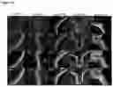 Fig. 20 - OPTIMIZED GENE THERAPY TARGETING RETINAL CELLS