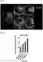 Fig. 23 - OPTIMIZED GENE THERAPY TARGETING RETINAL CELLS