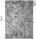 Fig. 02 - MACROPHAGE IMAGING AGENT