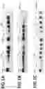 Fig. 02 - Methods of coating antimicrobial peptides on the biomaterial and the biomaterial coated thereby