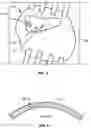Fig. 04 - DEVICES AND METHODS FOR TREATING TINNITUS USING ELECTRICAL STIMULATION