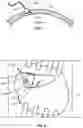 Fig. 05 - DEVICES AND METHODS FOR TREATING TINNITUS USING ELECTRICAL STIMULATION