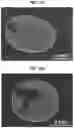 Fig. 23 - POINT OF CARE DROPLET DIGITAL PCR