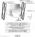 Fig. 09 - MRI apparatus