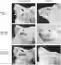 Fig. 01 - METHOD OF PREPARING MOUSE MODEL OF HERPES