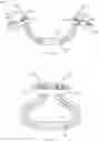 Fig. 02 - METHODS AND DEVICES FOR TISSUE GRAFT FIXATION