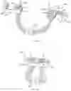 Fig. 03 - METHODS AND DEVICES FOR TISSUE GRAFT FIXATION