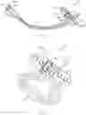 Fig. 05 - METHODS AND DEVICES FOR TISSUE GRAFT FIXATION