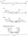 Fig. 16 - METHODS AND DEVICES FOR TISSUE GRAFT FIXATION