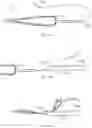 Fig. 47 - METHODS AND DEVICES FOR TISSUE GRAFT FIXATION