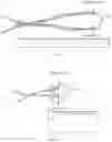 Fig. 55 - METHODS AND DEVICES FOR TISSUE GRAFT FIXATION