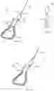 Fig. 79 - METHODS AND DEVICES FOR TISSUE GRAFT FIXATION