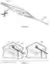 Fig. 87 - METHODS AND DEVICES FOR TISSUE GRAFT FIXATION