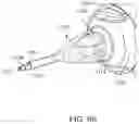 Fig. 18 - Ophthalmic cutting instruments having integrated aspiration pump