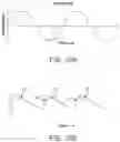 Fig. 20 - Ophthalmic cutting instruments having integrated aspiration pump