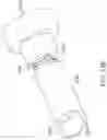 Fig. 33 - Ophthalmic cutting instruments having integrated aspiration pump