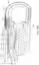 Fig. 39 - Ophthalmic cutting instruments having integrated aspiration pump