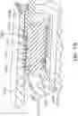 Fig. 40 - Ophthalmic cutting instruments having integrated aspiration pump