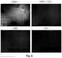 Fig. 06 - GENERATION OF NEURAL STEM CELL LINES DERIVED FROM HUMAN PLURIPOTENT STEM CELLS