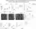 Fig. 01 - TARGETING LUNG-RESIDENT TNFR2+ cDC2 (R2D2) SUBPOPULATION TO TREAT ASTHMA