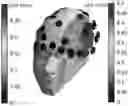 Fig. 01 - SYSTEMS AND METHODS FOR TREATING TUMORS USING TARGETED NEUROSTIMULATION