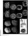 Fig. 04 - SYSTEMS AND METHODS FOR TREATING TUMORS USING TARGETED NEUROSTIMULATION