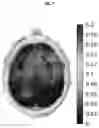 Fig. 08 - SYSTEMS AND METHODS FOR TREATING TUMORS USING TARGETED NEUROSTIMULATION