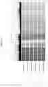 Fig. 32 - PRODUCTION METHOD AND KIT OF INDUCED PLURIPOTENT STEM CELLS