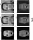 Fig. 06 - TECHNIQUES FOR ENHANCING SKIN RENDERS USING NEURAL NETWORK PROJECTION FOR RENDERING COMPLETION