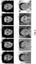 Fig. 09 - TECHNIQUES FOR ENHANCING SKIN RENDERS USING NEURAL NETWORK PROJECTION FOR RENDERING COMPLETION