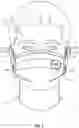 Fig. 03 - Temperature-sensing facemask with display