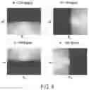 Fig. 07 - Super-Resolution Microvessel Imaging Using Separated Subsets of Ultrasound Data