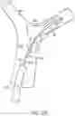 Fig. 04 - Single insertion delivery system for treating embolism and associated systems and methods