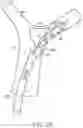 Fig. 07 - Single insertion delivery system for treating embolism and associated systems and methods